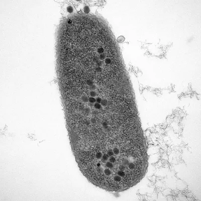 (Foto de ARCHIVO)

Bacterias infectadas por fagos. Los puntos muestran la replicación del fago.



REMITIDA / HANDOUT por UNIVERSIDAD DE SOUTHAMPTON

Fotografía remitida a medios de comunicación exclusivamente para ilustrar la noticia a la que hace referencia la imagen, y citando la procedencia de la imagen en la firma

28/7/2025