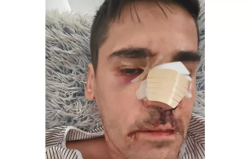 agresión a Fonsi Loaiza