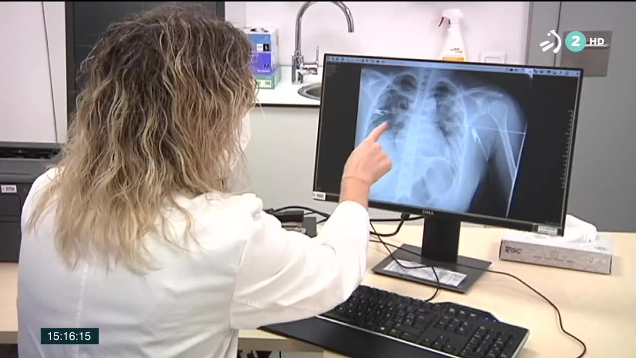 Son personas que siguen con síntomas como fatiga cronica, dolor de cabeza o fiebre muchos después de la infección. No hay un perfil único, pero, de momento, está afectando sobre todo a mujeres sin patologías previas, y cada vez más a jóvenes y niños.