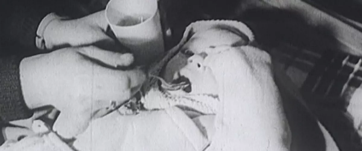 Afectados por la polio exigen medidas sanitarias y sociales urgentes ante el agravamiento de sus secuelas